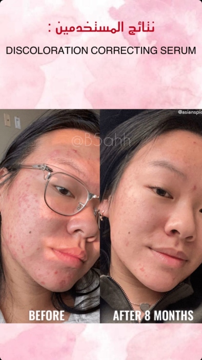Good molecules, DISCOLORATION CORRECTING SERUM جود موليكيولز، سيروم تصحيح اللون 